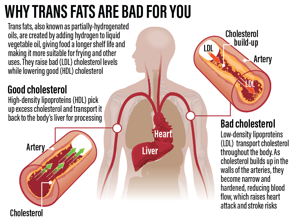 Trans Fats, what are they and how they effect your health?